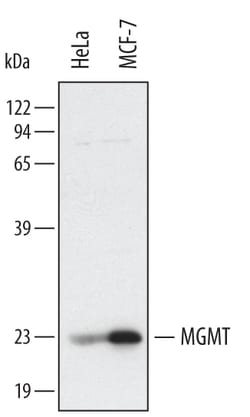 Human MGMT Antibody, R D Systems 100&mu;g; Unlabeled:Antibodies, Polyclonal