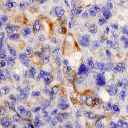 Human MIA Antibody, R D Systems 25&mu;g; Unlabeled:Antibodies, Polyclonal