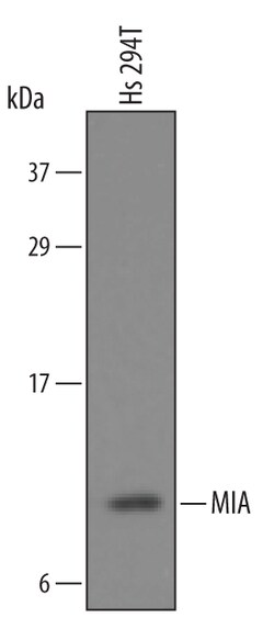 Human MIA Antibody, R D Systems 25&mu;g; Unlabeled:Antibodies, Polyclonal