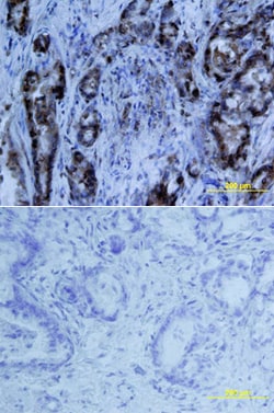 Human MIA Antibody, R D Systems 100ug; Unlabeled:Antibodies, Monoclonal