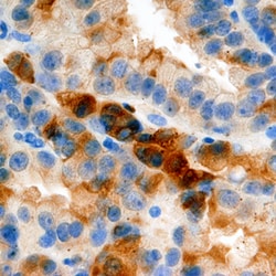 Human Midkine Antibody, R D Systems 25&mu;g; Unlabeled:Antibodies, Polyclonal