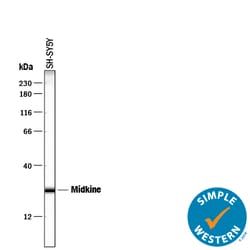 Human Midkine Antibody, R D Systems 25&mu;g; Unlabeled:Antibodies, Polyclonal