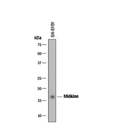 Human Midkine Antibody, R D Systems 25&mu;g; Unlabeled:Antibodies, Polyclonal