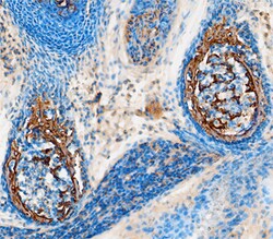 Mouse Midkine Antibody, R D Systems 25&mu;g; Unlabeled:Antibodies, Polyclonal