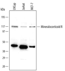 Human Mineralocorticoid R/NR3C2 Antibody, R D Systems 100ug; Unlabeled:Antibodies,
