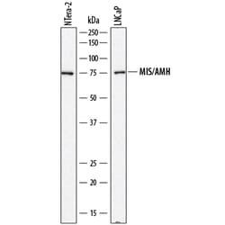 Human MIS/AMH Antibody, R D Systems 25&mu;g; Unlabeled:Antibodies, Monoclonal