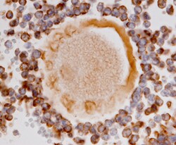 Human MIS RII Antibody, R D Systems 100&mu;g; Unlabeled:Antibodies, Polyclonal