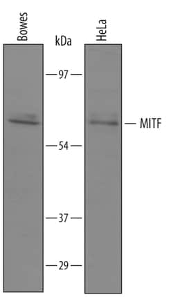 Human MITF Antibody, R D Systems 25&mu;g; Unlabeled:Antibodies, Polyclonal