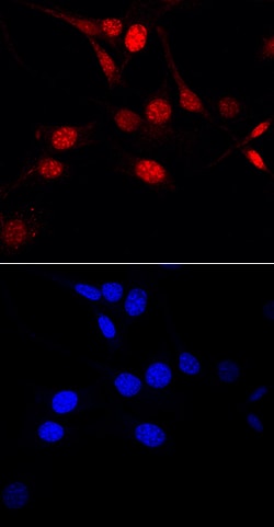 Mouse Ki67/MKI67 Antibody, R D Systems 25&mu;g; Unlabeled:Antibodies, Polyclonal