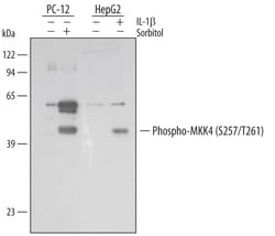 Human/Mouse/Rat Phospho-MKK4 (S257/T261) Antibody, R D Systems 25&mu;g;
