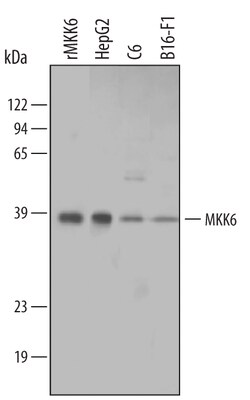 Human/Mouse/Rat MKK6 Antibody, R D Systems 25&mu;g; Unlabeled:Antibodies,