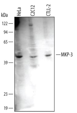 Human/Mouse/Rat MKP-3 Antibody, R D Systems 100ug; Unlabeled:Antibodies,
