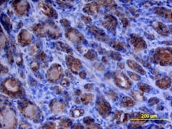 Human MMP-1 Antibody, R D Systems 25&mu;g; Unlabeled:Antibodies, Polyclonal