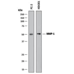 Human MMP-1 Antibody, R D Systems 25&mu;g; Unlabeled:Antibodies, Polyclonal