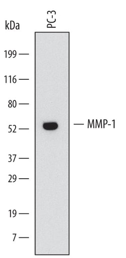 Human MMP-1 Antibody, R D Systems 25&mu;g; Unlabeled:Antibodies, Monoclonal
