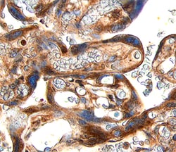 Human MMP-10 Antibody, R D Systems 25&mu;g; Unlabeled:Antibodies, Polyclonal