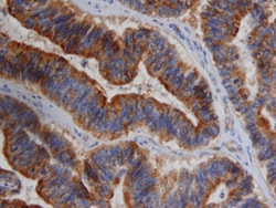 Human MMP-10 Antibody, R D Systems:Antibodies:Primary Antibodies