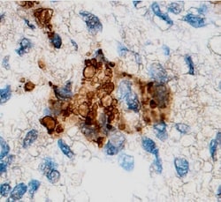 Human MMP-13 Antibody, R D Systems 25&mu;g; Unlabeled:Antibodies, Polyclonal