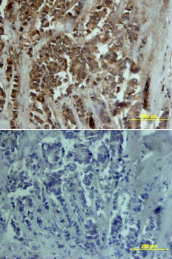 Human MMP-13 Antibody, R D Systems 25&mu;g; Unlabeled:Antibodies, Polyclonal