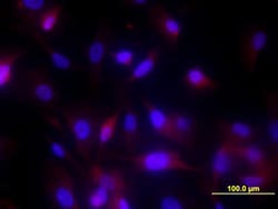 Human MMP-13 Antibody, R D Systems:Antibodies:Primary Antibodies