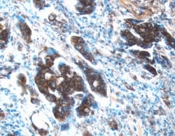 Human MMP-13 Antibody, R D Systems:Antibodies:Primary Antibodies