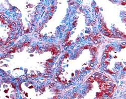 Human MMP-14/MT1-MMP Antibody, R D Systems 25&mu;g; Unlabeled:Antibodies,