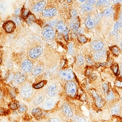 Human MMP-19 Antibody, R D Systems 100&mu;g; Unlabeled:Antibodies, Polyclonal