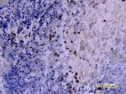 Human MMP-2 Antibody, R D Systems 100&mu;g; Unlabeled:Antibodies, Polyclonal