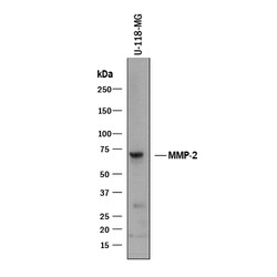 Human MMP-2 Antibody, R D Systems 100&mu;g; Unlabeled:Antibodies, Polyclonal