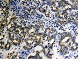 Human MMP-2 Antibody, R D Systems 25&mu;g; Unlabeled:Antibodies, Monoclonal