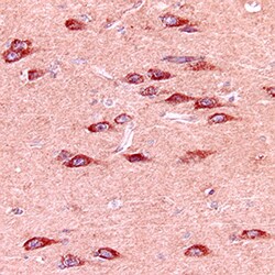Human/Mouse MMP-24/MT5-MMP Antibody, R D Systems 200&mu;g; Unlabeled:Antibodies,