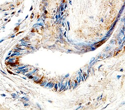 Human MMP-25/MT6-MMP Hemopexin Domain Antibody, R D Systems 500ug; Unlabeled:Antibodies,