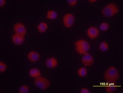 Human MMP-3 Antibody, R D Systems 25&mu;g; Unlabeled:Antibodies, Monoclonal