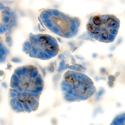 Mouse MMP-7 Antibody, R D Systems 25&mu;g; Unlabeled:Antibodies, Polyclonal