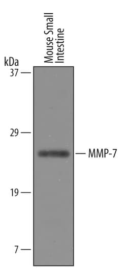 Mouse MMP-7 Antibody, R D Systems 25&mu;g; Unlabeled:Antibodies, Polyclonal