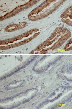 Human MMP-7 Antibody, R D Systems 100&mu;g; Unlabeled:Antibodies, Polyclonal