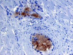 Human Pro-MMP-7 Antibody, R D Systems 25&mu;g; Unlabeled:Antibodies, Monoclonal
