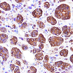 Human MMP-8 Biotinylated Antibody, R D Systems 50&mu;g; Biotin:Antibodies,