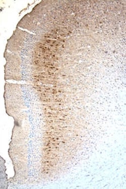 Mouse MMP-9 Antibody, R D Systems 25&mu;g; Unlabeled:Antibodies, Polyclonal