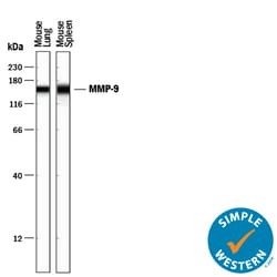 Mouse MMP-9 Antibody, R D Systems 25&mu;g; Unlabeled:Antibodies, Polyclonal