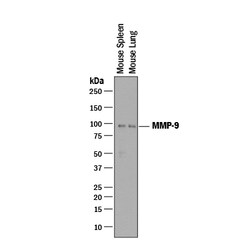 Mouse MMP-9 Antibody, R D Systems 25&mu;g; Unlabeled:Antibodies, Polyclonal