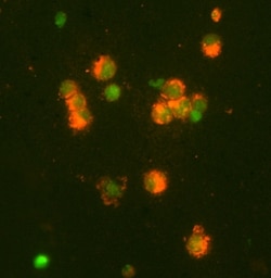Human MMP-9 Antibody, R D Systems 25&mu;g; Unlabeled:Antibodies, Polyclonal