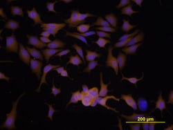 Human MMP-9 Antibody, R D Systems 25&mu;g; Unlabeled:Antibodies, Polyclonal