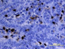 Human MMP-9 Antibody, R D Systems 25&mu;g; Unlabeled:Antibodies, Polyclonal