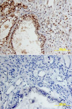 Human MMP-9 Antibody, R D Systems 25&mu;g; Unlabeled:Antibodies, Polyclonal