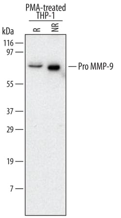 Human Pro MMP-9 Antibody, R D Systems 25&mu;g; Unlabeled:Antibodies, Monoclonal