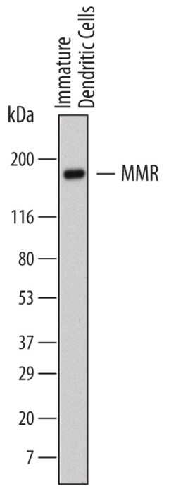 Human MMR/CD206 Antibody, R D Systems 25&mu;g; Unlabeled:Antibodies, Monoclonal