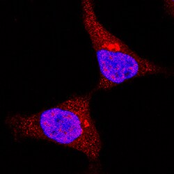Human/Mouse MSK1 Antibody, R D Systems 25&mu;g; Unlabeled:Antibodies, Polyclonal