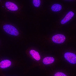 Human Phospho-MSK1(S376)/MSK2(S360) Antibody, R D Systems 100&mu;g; Unlabeled:Antibodies,