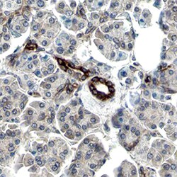 Human/Mouse Phospho-MSK2/RSKB (S196) Antibody, R D Systems 25&mu;g; Unlabeled:Antibodies,